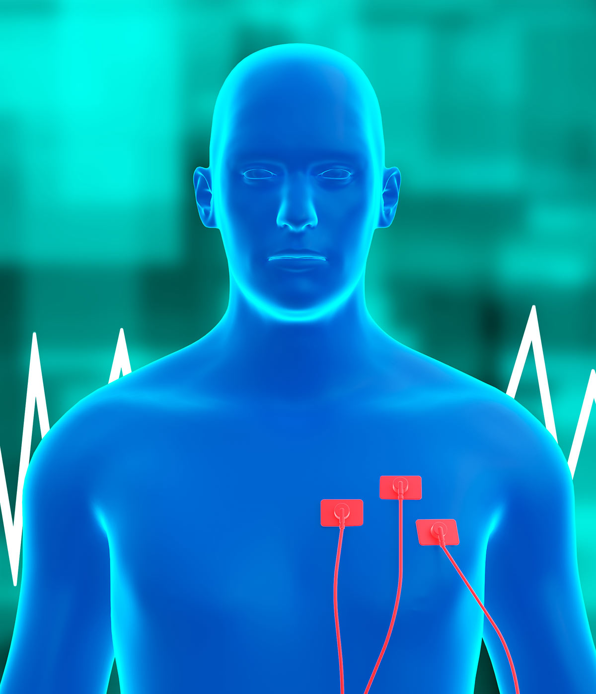 Holter Monitor Edmonton Echolab